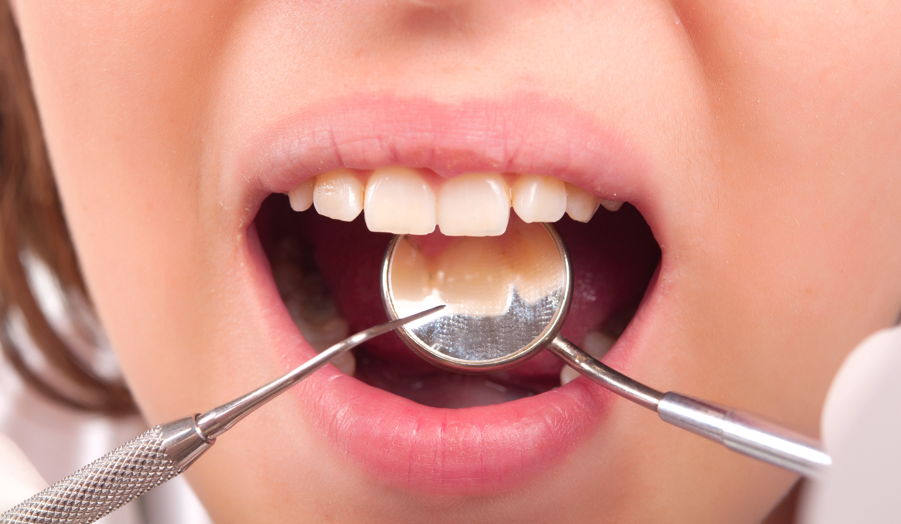 Dentist Pediatric St. Louis
